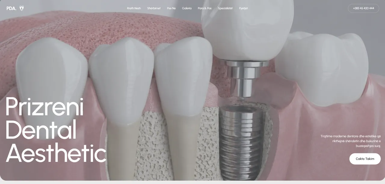 Faqja e Prizreni Dental Aesthetic me ilustrim të një implanti dentar